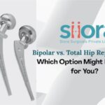 Bipolar vs. Total Hip Replacement: